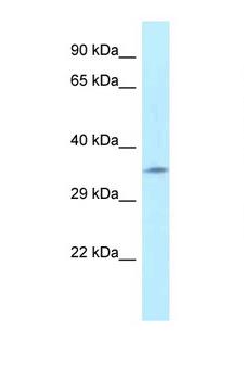 FAHD2A Antibody - FAHD2A antibody Western blot of Fetal Kidney lysate. Antibody concentration 1 ug/ml.  This image was taken for the unconjugated form of this product. Other forms have not been tested.