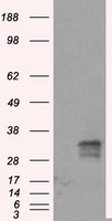 FAHD2A Antibody - HEK293T cells were transfected with the pCMV6-ENTRY control (Left lane) or pCMV6-ENTRY FAHD2A (Right lane) cDNA for 48 hrs and lysed. Equivalent amounts of cell lysates (5 ug per lane) were separated by SDS-PAGE and immunoblotted with anti-FAHD2A.