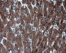 FAHD2A Antibody - Immunohistochemical staining of paraffin-embedded liver tissue using anti-FAHD2A mouse monoclonal antibody. (Dilution 1:50).