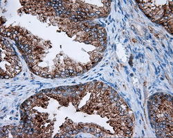 FAHD2A Antibody - Immunohistochemical staining of paraffin-embedded prostate tissue using anti-FAHD2A mouse monoclonal antibody. (Dilution 1:50).