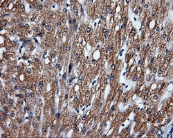 FAHD2A Antibody - IHC of paraffin-embedded liver tissue using anti-FAHD2A mouse monoclonal antibody. (Dilution 1:50).