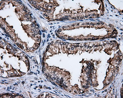 FAHD2A Antibody - IHC of paraffin-embedded prostate tissue using anti-FAHD2A mouse monoclonal antibody. (Dilution 1:50).