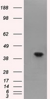 FAHD2A Antibody - HEK293T cells were transfected with the pCMV6-ENTRY control (Left lane) or pCMV6-ENTRY FAHD2A (Right lane) cDNA for 48 hrs and lysed. Equivalent amounts of cell lysates (5 ug per lane) were separated by SDS-PAGE and immunoblotted with anti-FAHD2A.
