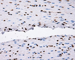FAHD2A Antibody - IHC of paraffin-embedded colon tissue using anti-FAHD2A mouse monoclonal antibody. (Dilution 1:50).