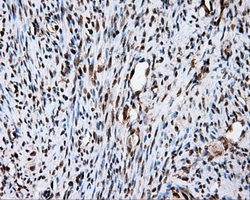 FAHD2A Antibody - IHC of paraffin-embedded endometrium tissue using anti-FAHD2A mouse monoclonal antibody. (Dilution 1:50).