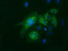 FAHD2A Antibody - Anti-FAHD2A mouse monoclonal antibody  immunofluorescent staining of COS7 cells transiently transfected by pCMV6-ENTRY FAHD2A.
