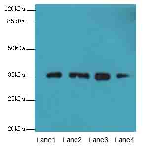 FAHD2A Antibody - Western blot. All lanes: FAHD2A antibody at 0.5 ug/ml. Lane 1: K562 whole cell lysate. Lane 2: U87 whole cell lysate. Lane 3: A549 whole cell lysate. Lane 4: MCF7 whole cell lysate. Secondary Goat polyclonal to Rabbit IgG at 1:10000 dilution. Predicted band size: 35 kDa. Observed band size: 35 kDa.