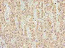 FAHD2A Antibody - Immunohistochemistry of paraffin-embedded human adrenal gland tissue using antibody at dilution of 1:100.