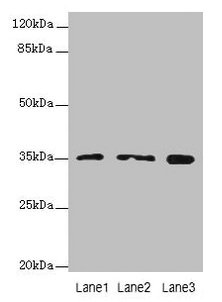 FAHD2A Antibody - Western blot All lanes: FAHD2A antibody at 0.5µg/ml Lane 1: K562 whole cell lysate Lane 2: U87 whole cell lysate Lane 3: A549 whole cell lysate Lane 4: MCF-7 whole cell lysate Secondary Goat polyclonal to rabbit IgG at 1/10000 dilution Predicted band size: 35 kDa Observed band size: 35 kDa