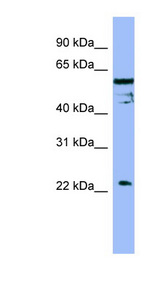 FAIM Antibody - FAIM / FAIM1 antibody Western blot of OVCAR-3 cell lysate. This image was taken for the unconjugated form of this product. Other forms have not been tested.