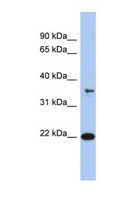 FAIM Antibody - FAIM / FAIM1 antibody Western blot of Jurkat lysate. This image was taken for the unconjugated form of this product. Other forms have not been tested.