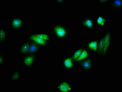 FAIM Antibody - Immunofluorescence staining of HepG2 cells with FAIM Antibody at 1:133, counter-stained with DAPI. The cells were fixed in 4% formaldehyde, permeabilized using 0.2% Triton X-100 and blocked in 10% normal Goat Serum. The cells were then incubated with the antibody overnight at 4°C. The secondary antibody was Alexa Fluor 488-congugated AffiniPure Goat Anti-Rabbit IgG(H+L).