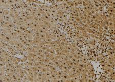 FAIM Antibody - 1:100 staining mouse liver tissue by IHC-P. The sample was formaldehyde fixed and a heat mediated antigen retrieval step in citrate buffer was performed. The sample was then blocked and incubated with the antibody for 1.5 hours at 22°C. An HRP conjugated goat anti-rabbit antibody was used as the secondary.