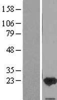 FAIM Protein - Western validation with an anti-DDK antibody * L: Control HEK293 lysate R: Over-expression lysate