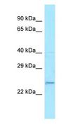 FAIM2 / LIFEGUARD Antibody - FAIM2 / LIFEGUARD antibody Western Blot of HepG2. Antibody dilution: 1 ug/ml.  This image was taken for the unconjugated form of this product. Other forms have not been tested.