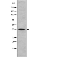 FAIM2 / LIFEGUARD Antibody - Western blot analysis FAIM2 using COLO205 whole cells lysates