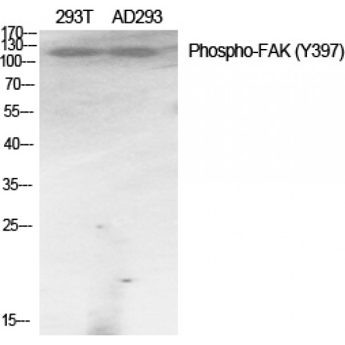 FAK / Focal Adhesion Kinase Antibody - Western blot of Phospho-FAK (Y397) antibody