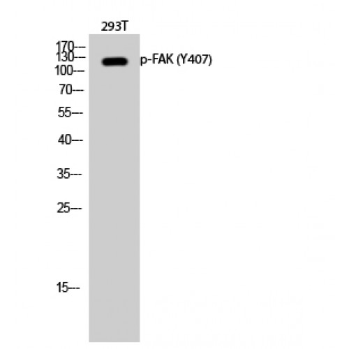 FAK / Focal Adhesion Kinase Antibody - Western blot of Phospho-FAK (Y407) antibody