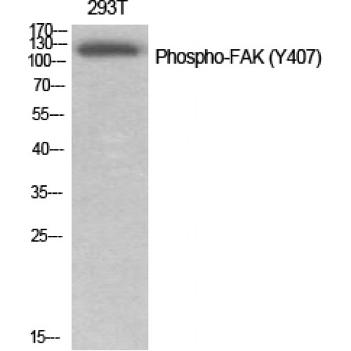 FAK / Focal Adhesion Kinase Antibody - Western blot of Phospho-FAK (Y407) antibody