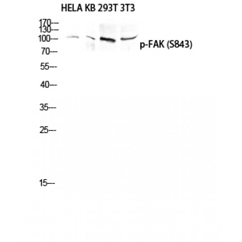 FAK / Focal Adhesion Kinase Antibody - Western blot of Phospho-FAK (S843) antibody