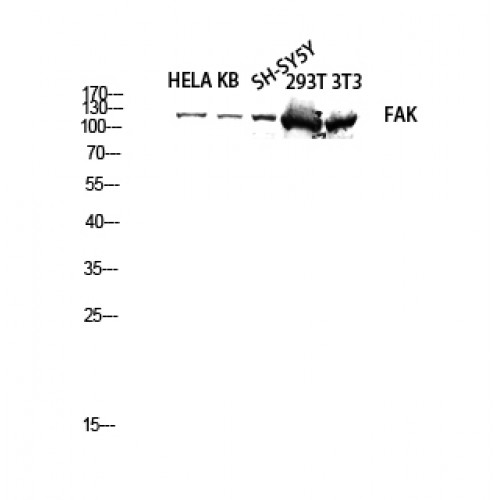 FAK / Focal Adhesion Kinase Antibody - Western blot of FAK antibody