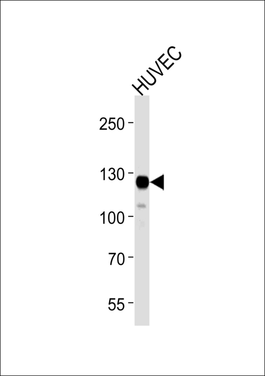 FAK / Focal Adhesion Kinase Antibody - Western blot of lysate from HUVEC cell line with PTK2 Antibody. Antibody was diluted at 1:1000 at each lane. A goat anti-mouse IgG H&L (HRP) at 1:3000 dilution was used as the secondary antibody. Lysate at 35 ug per lane.