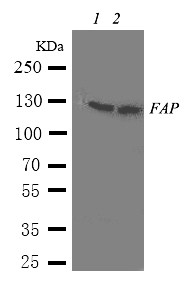 FAK / Focal Adhesion Kinase Antibody - WB of FAK / Focal Adhesion Kinase antibody. Lane 1: Rat Brain Tissue Lysate. Lane 2: Rat Liver Tissue Lysate.