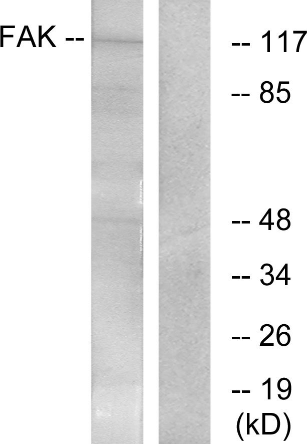 FAK / Focal Adhesion Kinase Antibody - Western blot analysis of lysates from Jurkat cells, treated with CD3 antibody, using FAK Antibody. The lane on the right is blocked with the synthesized peptide.
