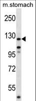 FAK / Focal Adhesion Kinase Antibody - Mouse Ptk2 Antibody western blot of mouse stomach tissue lysates (35 ug/lane). The Ptk2 antibody detected the Ptk2 protein (arrow).