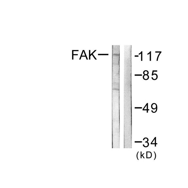 FAK / Focal Adhesion Kinase Antibody - Western blot analysis of lysates from NIH/3T3 cells, using FAK Antibody. The lane on the right is blocked with the synthesized peptide.