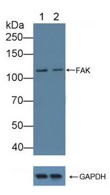 FAK / Focal Adhesion Kinase Antibody - Knockout Varification: Lane 1: Wild-type Jurkat cell lysate; Lane 2: FAK knockout Jurkat cell lysate; Predicted MW: 39,48,63,100,120kd Observed MW: 120kd Primary Ab: 1µg/ml Rabbit Anti-Human FAK Antibody Second Ab: 0.2µg/mL HRP-Linked Caprine Anti-Rabbit IgG Polyclonal Antibody