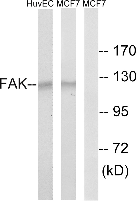 FAK / Focal Adhesion Kinase Antibody - Western blot analysis of lysates from MCF-7 and HUVEC cells, using FAK Antibody. The lane on the right is blocked with the synthesized peptide.