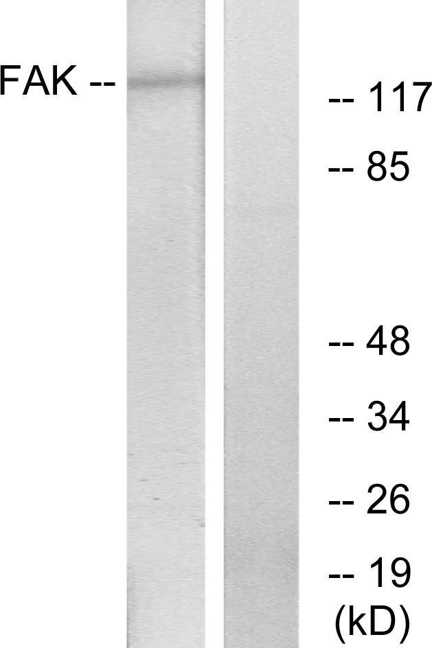 FAK / Focal Adhesion Kinase Antibody - Western blot analysis of lysates from HeLa cells, treated with Serum, using FAK Antibody. The lane on the right is blocked with the synthesized peptide.
