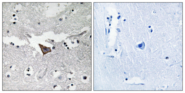 FAK / Focal Adhesion Kinase Antibody - Immunohistochemistry analysis of paraffin-embedded human brain tissue, using FAK Antibody. The picture on the right is blocked with the synthesized peptide.