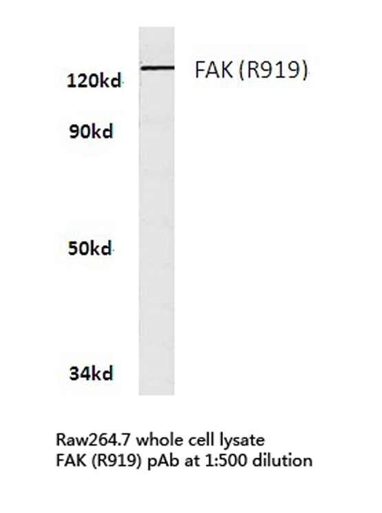 FAK / Focal Adhesion Kinase Antibody - Western blot of FAK (R919) pAb in extracts from raw264.7 cells.