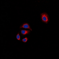FAK / Focal Adhesion Kinase Antibody - Immunofluorescent analysis of Focal Adhesion Kinase staining in HT29 cells. Formalin-fixed cells were permeabilized with 0.1% Triton X-100 in TBS for 5-10 minutes and blocked with 3% BSA-PBS for 30 minutes at room temperature. Cells were probed with the primary antibody in 3% BSA-PBS and incubated overnight at 4 deg C in a humidified chamber. Cells were washed with PBST and incubated with a DyLight 594-conjugated secondary antibody (red) in PBS at room temperature in the dark. DAPI was used to stain the cell nuclei (blue).