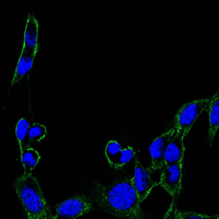 FAK / Focal Adhesion Kinase Antibody - Immunofluorescence of B16 cells using FAK mouse monoclonal antibody (green). Blue: DRAQ5 fluorescent DNA dye.