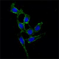 FAK / Focal Adhesion Kinase Antibody - Immunofluorescence of A549 cells using FAK mouse monoclonal antibody (green). Blue: DRAQ5 fluorescent DNA dye.