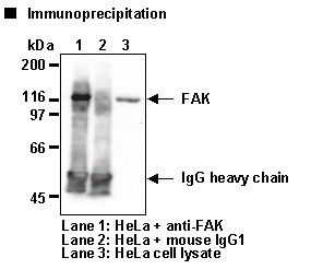 FAK / Focal Adhesion Kinase Antibody