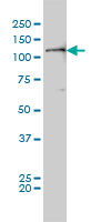 FAK / Focal Adhesion Kinase Antibody - PTK2 monoclonal antibody (M01), clone 2C3 Western Blot analysis of PTK2 expression in HeLa NE.