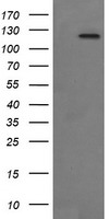 FAK / Focal Adhesion Kinase Antibody - HEK293T cells were transfected with the pCMV6-ENTRY control (Left lane) or pCMV6-ENTRY PTK2 (Right lane) cDNA for 48 hrs and lysed. Equivalent amounts of cell lysates (5 ug per lane) were separated by SDS-PAGE and immunoblotted with anti-PTK2.