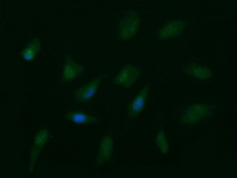 FAK / Focal Adhesion Kinase Antibody - Immunofluorescent staining of HeLa cells using anti-PTK2 mouse monoclonal antibody.