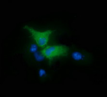 FAK / Focal Adhesion Kinase Antibody - Anti-PTK2 mouse monoclonal antibody immunofluorescent staining of COS7 cells transiently transfected by pCMV6-ENTRY PTK2.