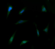 FAK / Focal Adhesion Kinase Antibody - Immunofluorescent staining of HeLa cells using anti-PTK2 mouse monoclonal antibody.