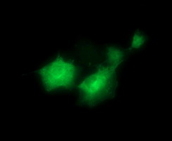 FAK / Focal Adhesion Kinase Antibody - Anti-PTK2 mouse monoclonal antibody immunofluorescent staining of COS7 cells transiently transfected by pCMV6-ENTRY PTK2.