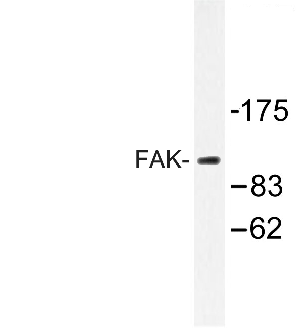 FAK / Focal Adhesion Kinase Antibody - Western blot of FAK (E393) pAb in extracts from 293 cells.