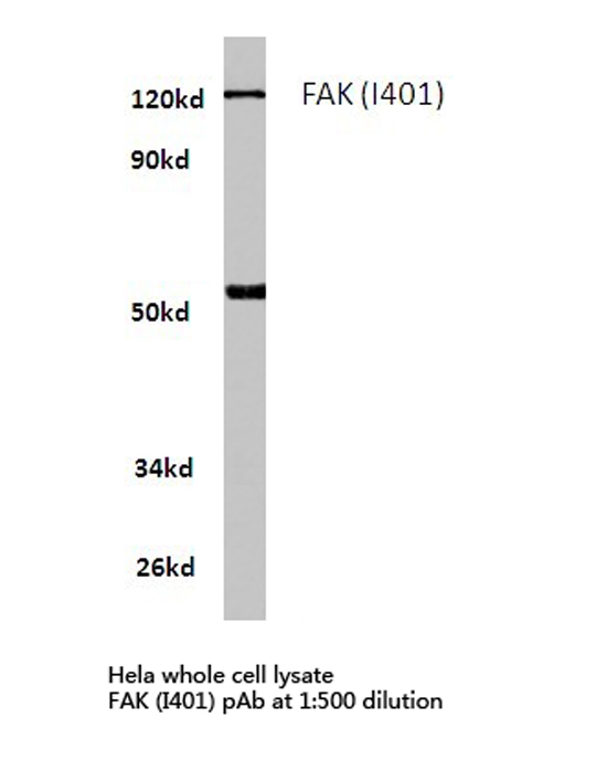 FAK / Focal Adhesion Kinase Antibody - Western blot of FAK (I401) pAb in extracts from HeLa cells.