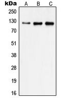 FAK / Focal Adhesion Kinase Antibody - Western blot analysis of Focal Adhesion Kinase expression in A431 (A); HeLa (B); MDAMB231 (C) whole cell lysates.
