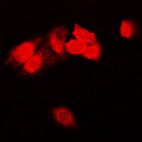 FAK / Focal Adhesion Kinase Antibody - Immunofluorescent analysis of Focal Adhesion Kinase staining in HeLa cells. Formalin-fixed cells were permeabilized with 0.1% Triton X-100 in TBS for 5-10 minutes and blocked with 3% BSA-PBS for 30 minutes at room temperature. Cells were probed with the primary antibody in 3% BSA-PBS and incubated overnight at 4 C in a humidified chamber. Cells were washed with PBST and incubated with a DyLight 594-conjugated secondary antibody (red) in PBS at room temperature in the dark. DAPI was used to stain the cell nuclei (blue).