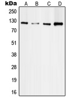 FAK / Focal Adhesion Kinase Antibody - Western blot analysis of Focal Adhesion Kinase expression in A431 (A); HeLa (B); MDAMB231 (C); NIH3T3 (D) whole cell lysates.